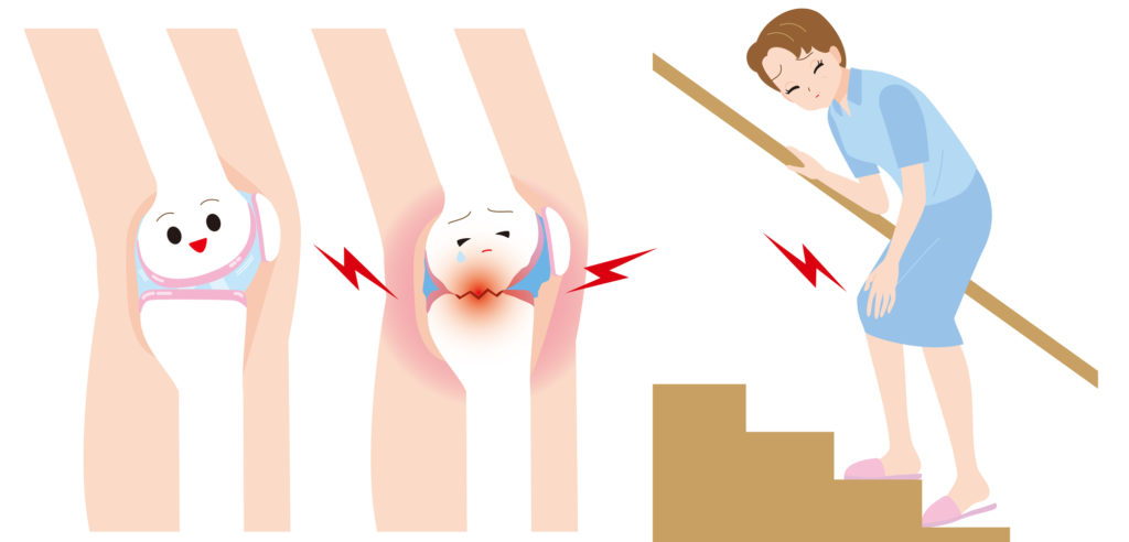 knee pain treatment near me - Cardin & Miller 