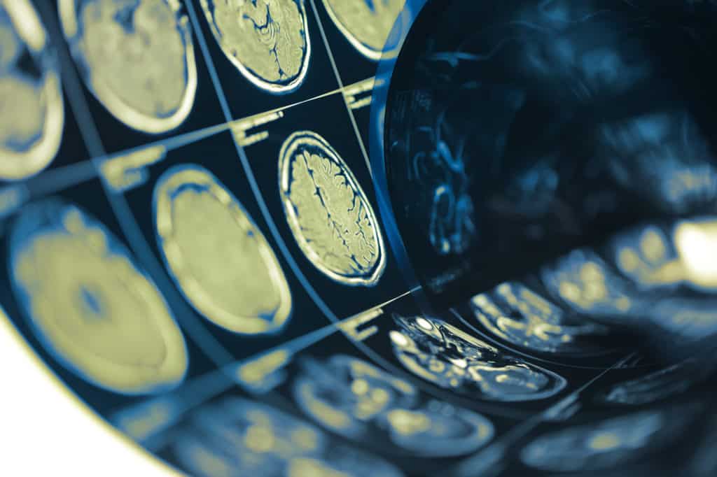 Human brain scan testing film folded in a roll, medical backgrou