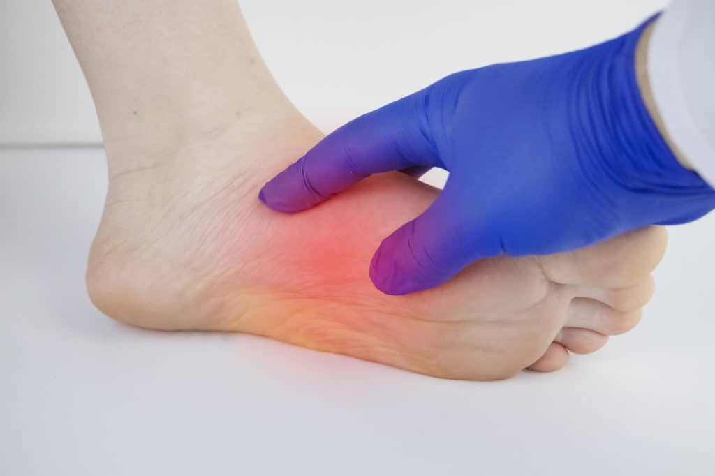 physical therapist examining patient with plantar fasciitis
