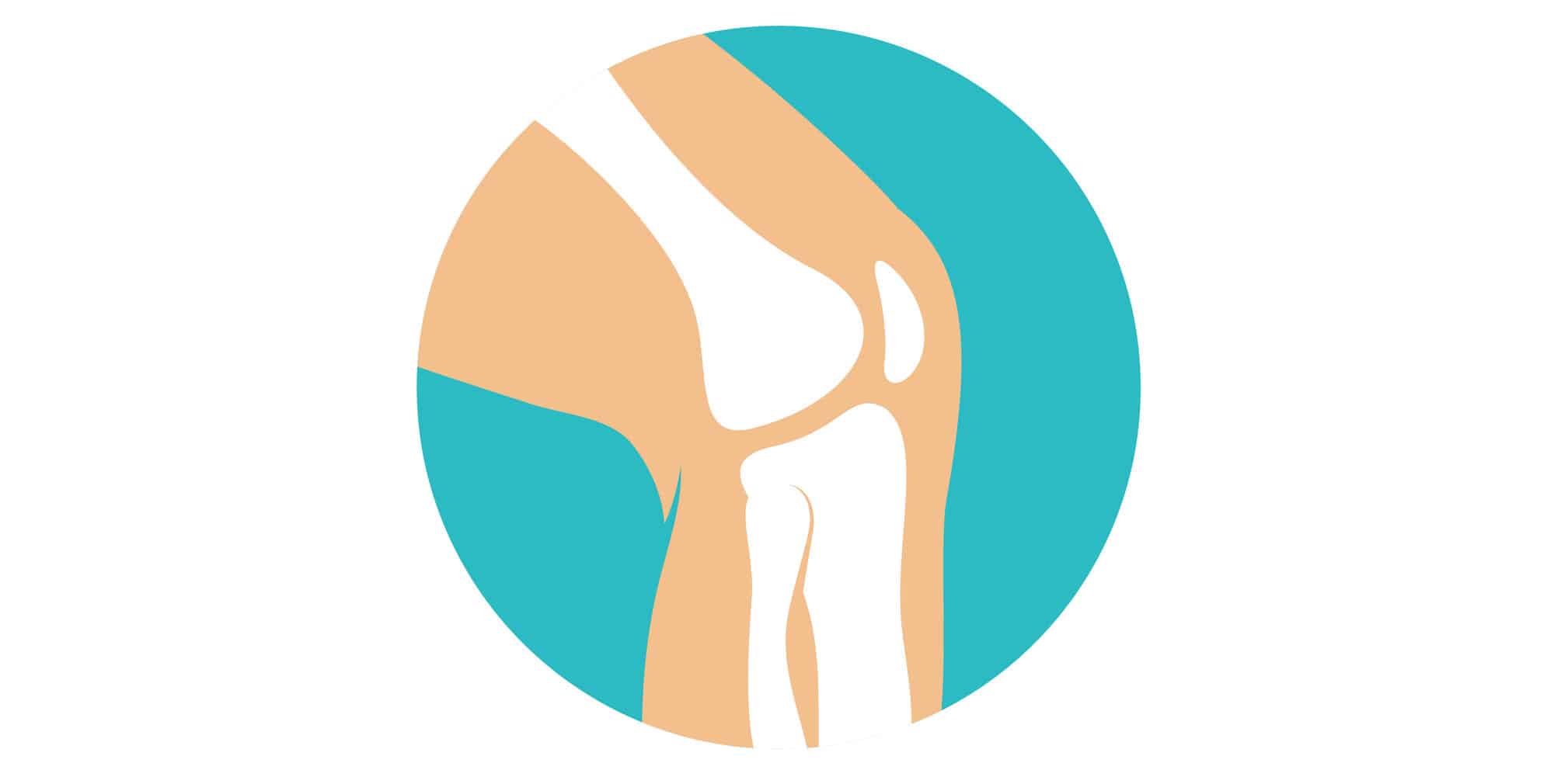Arthritis knee pain 