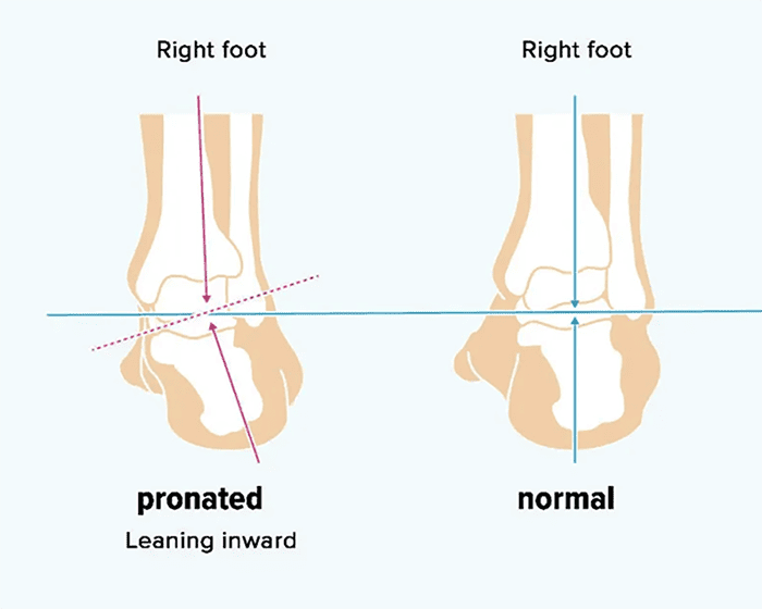foot pronation diagram