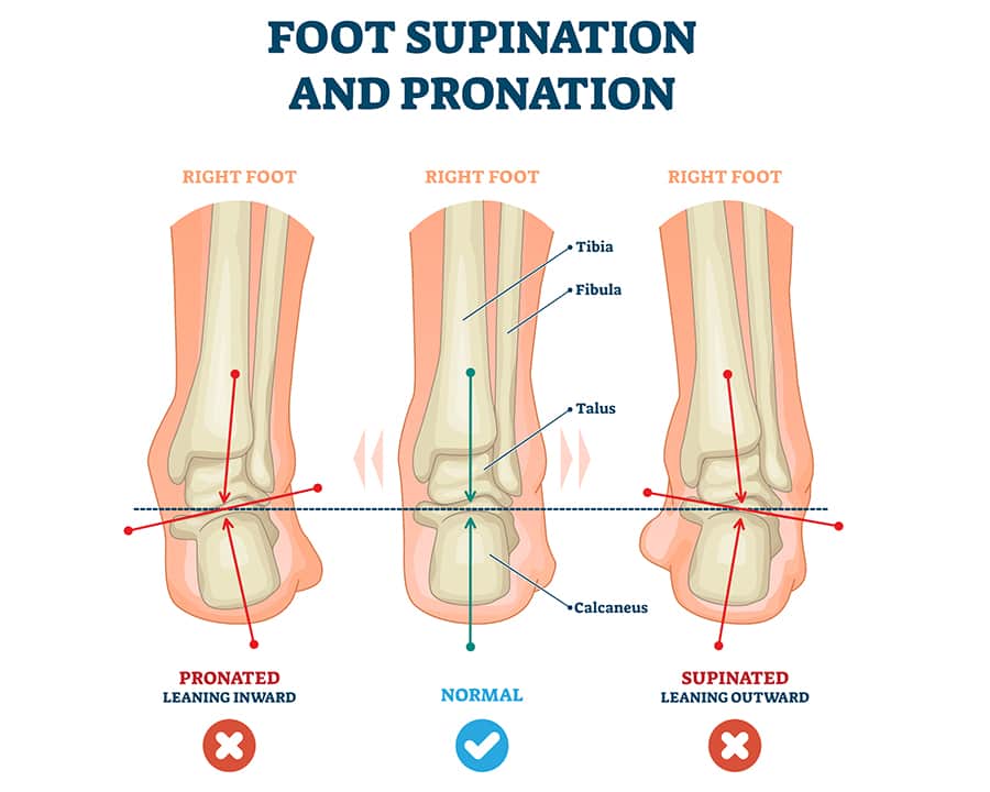 foot supination vs foot pronation
